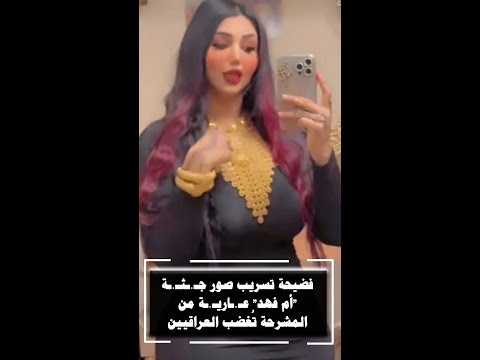 فضيحة تسريب صور جـثـة "أم فهد" عـاريـة من المشرحة تُغضب العراقيين