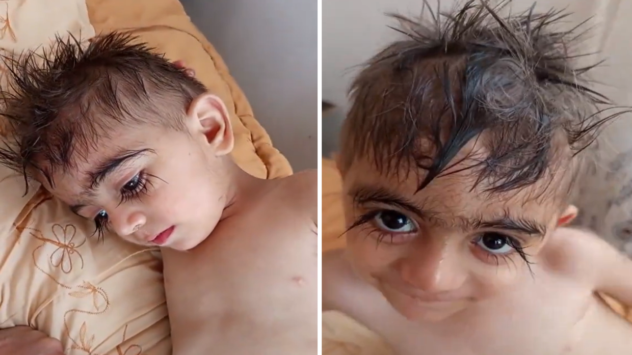 نشطاء يتفاعلون مع فيديو صاحب "أطول رموش في العالم" ..  وأقاربه يكشفون السر وراء ذلك