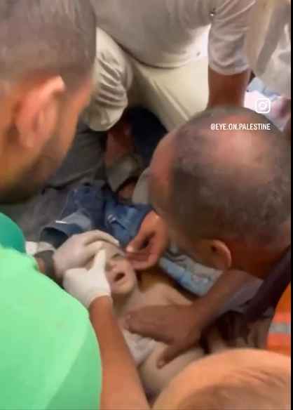 محاولة إنقاذ طفلة استشهدت في قصف على دير البلح - فيديو 