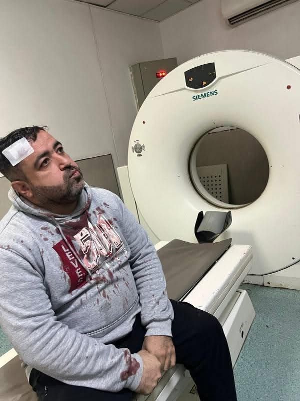 كما نشرت سرايا  ..  الامن يلقي القبض على الشخصين المعتديين على الصحفي التميمي في الزرقاء    .. فيديو 