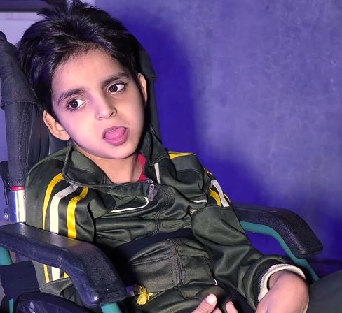 "حبة بطاطا تسببت بإصابته بالشلل" ..  والد الطفل موفق يروي معاناة ابنه ويناشد لإكمال علاجه - فيديو  