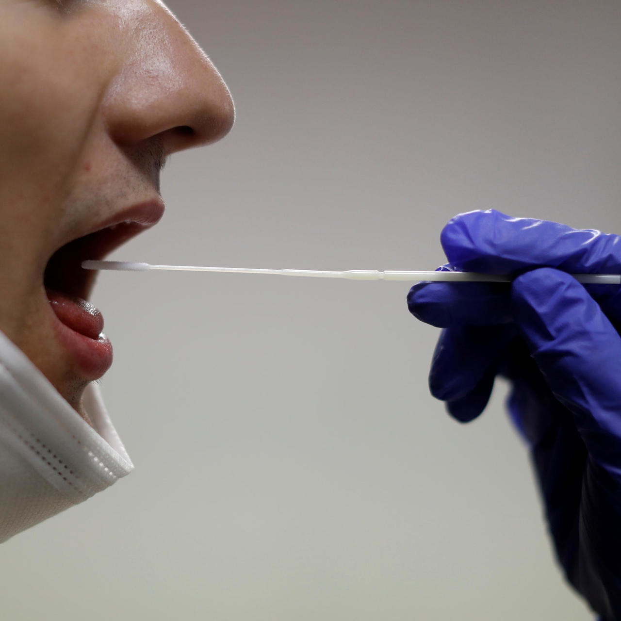 هل تم إحالة عطاء فحوصات الـ "PCR" عبر "معابر العقبة" لمختبر طبي بشكل "مجاني"؟ 