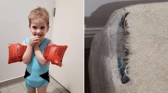 يعاني من حالة نادرة ..  طفل يأكل مفروشات منزله