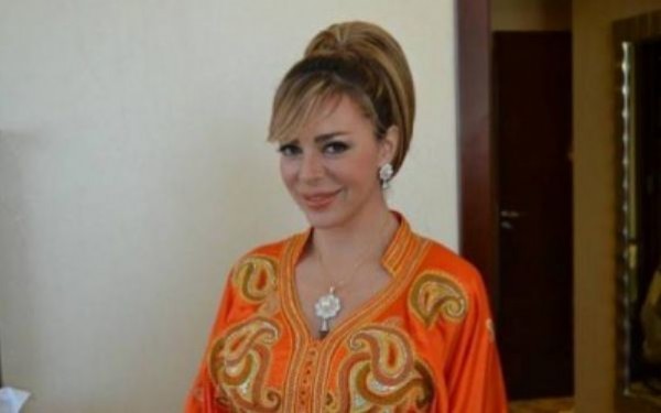 سوزان نجم الدين تُغير ملامحها بعمليات التجميل  ..  صورة صادمة