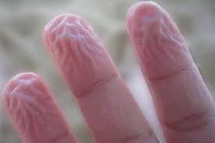 ما هي أسباب تقشر جلد الأصابع ومتى يجب رؤية الطبيب؟