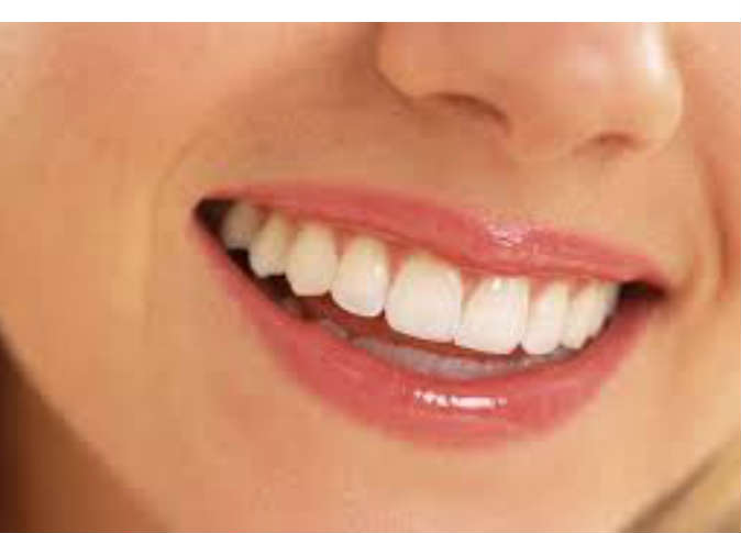 5 طرق للتخلص من اصفرار الأسنان