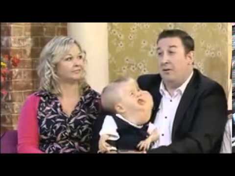 بالفيديو  ..  الطفل الذي أبكى العالم وحيّر الأطباء