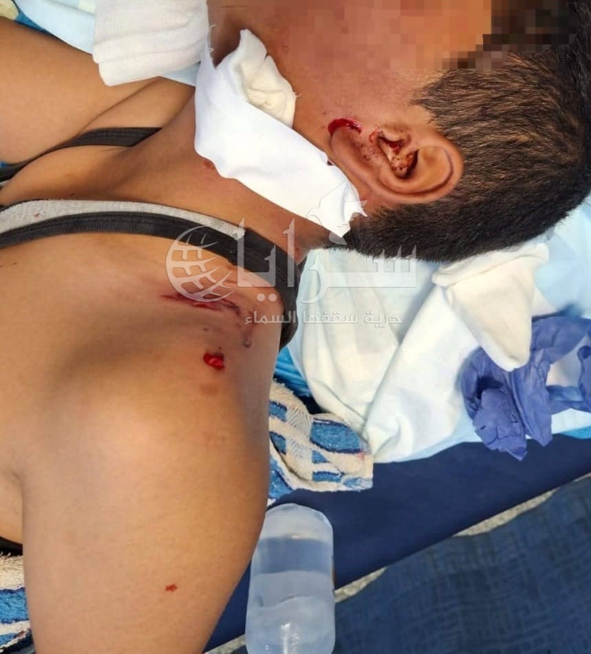 صور تقشعر لها الأبدان ..  طفل يتعرض لهجوم من كلاب ضالة أمام طوارئ مستشفى البادية الشمالية