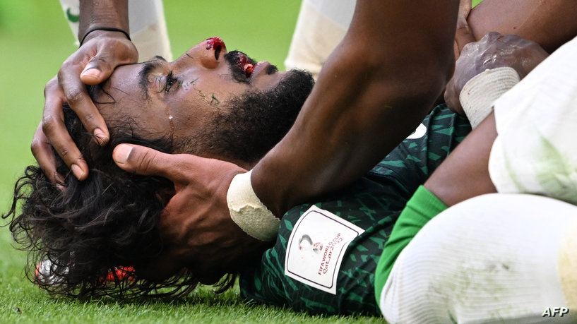 عملية ثانية للشهراني ..  والاتحاد السعودي يكشف تطورات وضعه الصحي