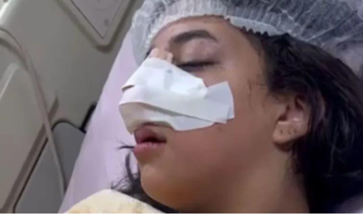 كسر انف طالبة بمشاجرة فتيات بمدرسة مصرية