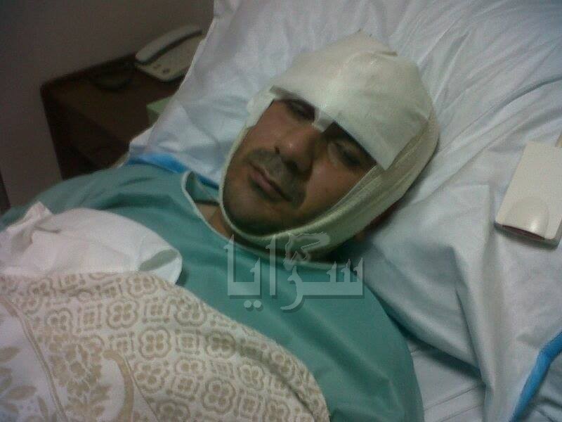 تبادل لكمات وضرب بالكراسي بين رئيس بلدية حكما ورئيس بلدية الصريح في إربد (صور)