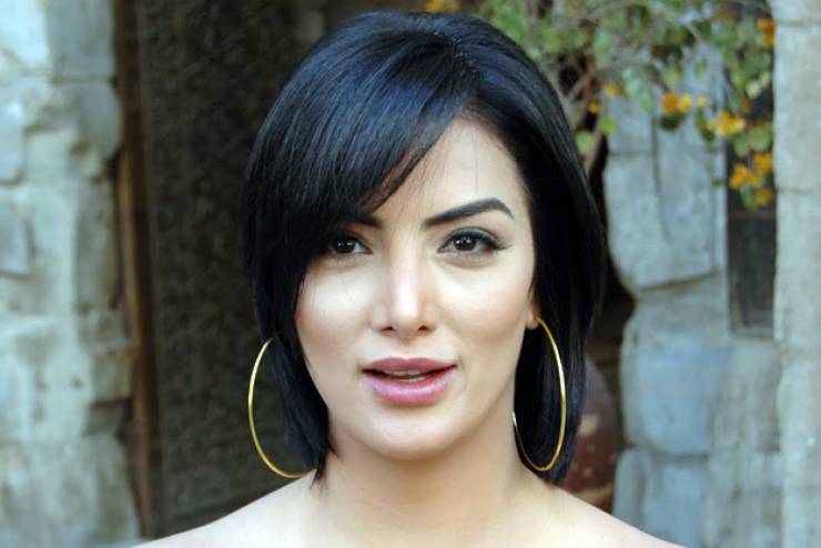 حورية فرغلي قبل وبعد التشوه  .. شاهد