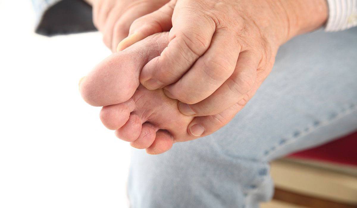 إليك علاج فطريات القدم بالطرق الطبيعية 