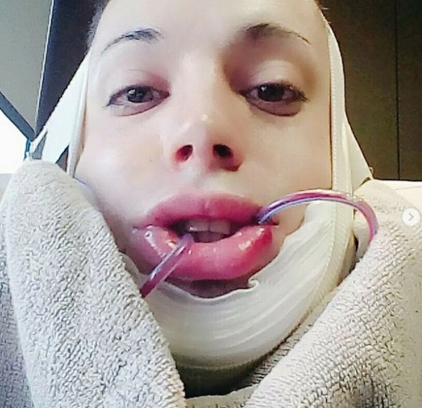 بالصور .. شاب يخضع لعملية تجميل ليتحول إلى "عفريت"