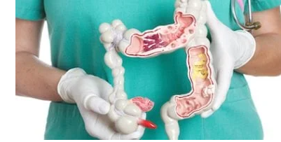 التصبغات من بينها: 5 علامات لسرطان القولون تظهر على الجلد