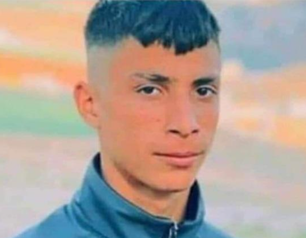 استشهاد فتى متأثرا بجروحه في نابلس