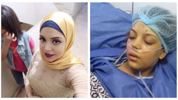 مأساة ..  "سهر" دخلت المستشفى للولادة فأصيبت بفشل كلوي وتسمم فى الدم