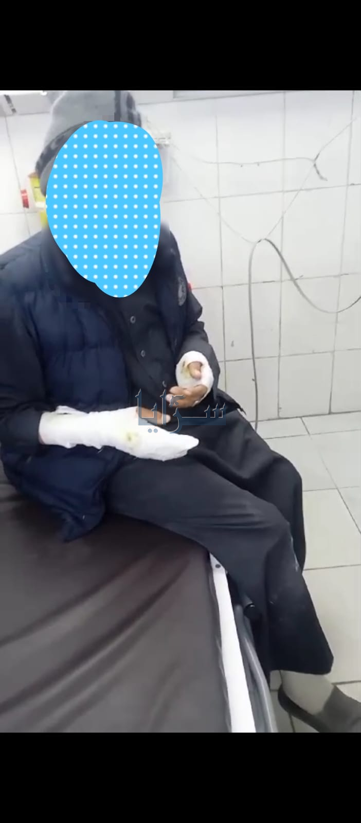 كلاب ضالة تعتدي على سيدة ورجل خمسيني وتصيبه بجروح خطيرة في خالدية المفرق  .. صورة 